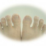 足の爪に黒い点が出現！この病気に注意して下さい！